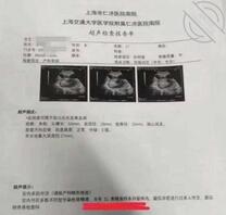 北京17岁女孩子宫内存31类精液样本，男朋友头顶一片青青草原！萝莉女神1